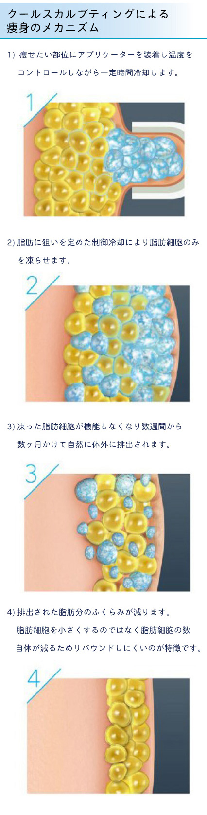 クルスカmb用_2-2