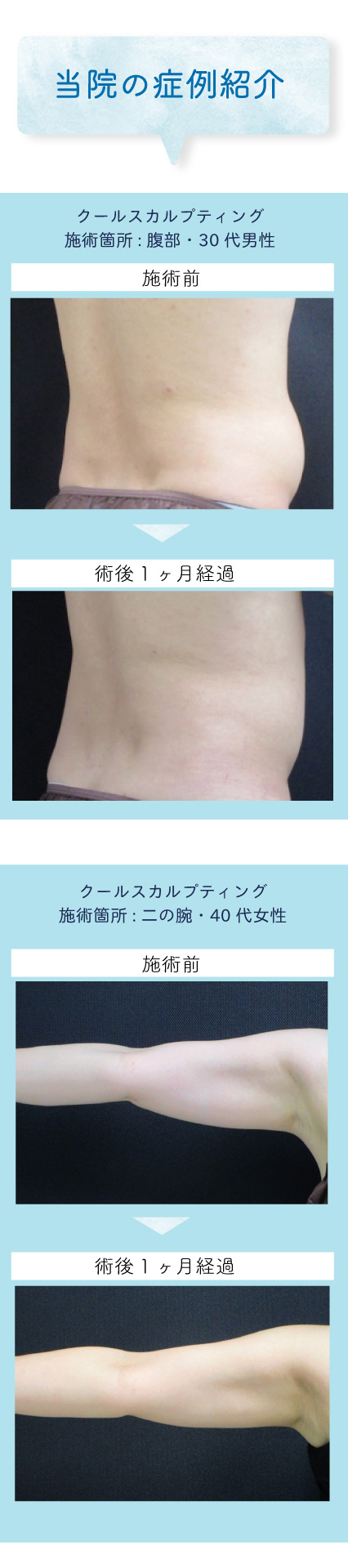 クルスカmb用_7