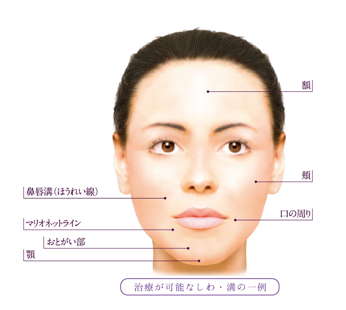 注入箇所1