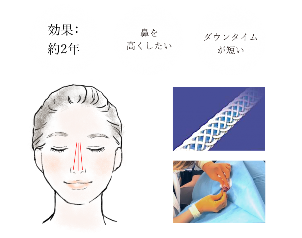 9 | 御所南はなこクリニック | 京都市中京区の皮膚科・美容皮膚科