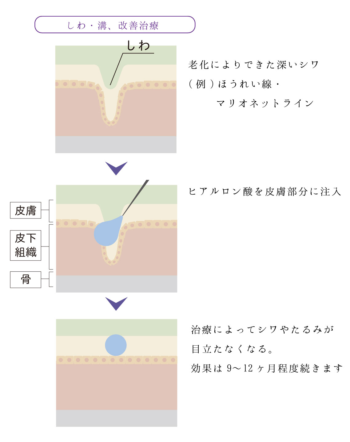 治療方法1