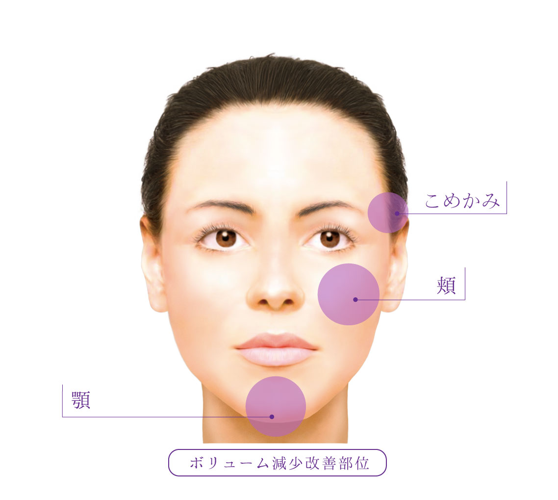 注入箇所2