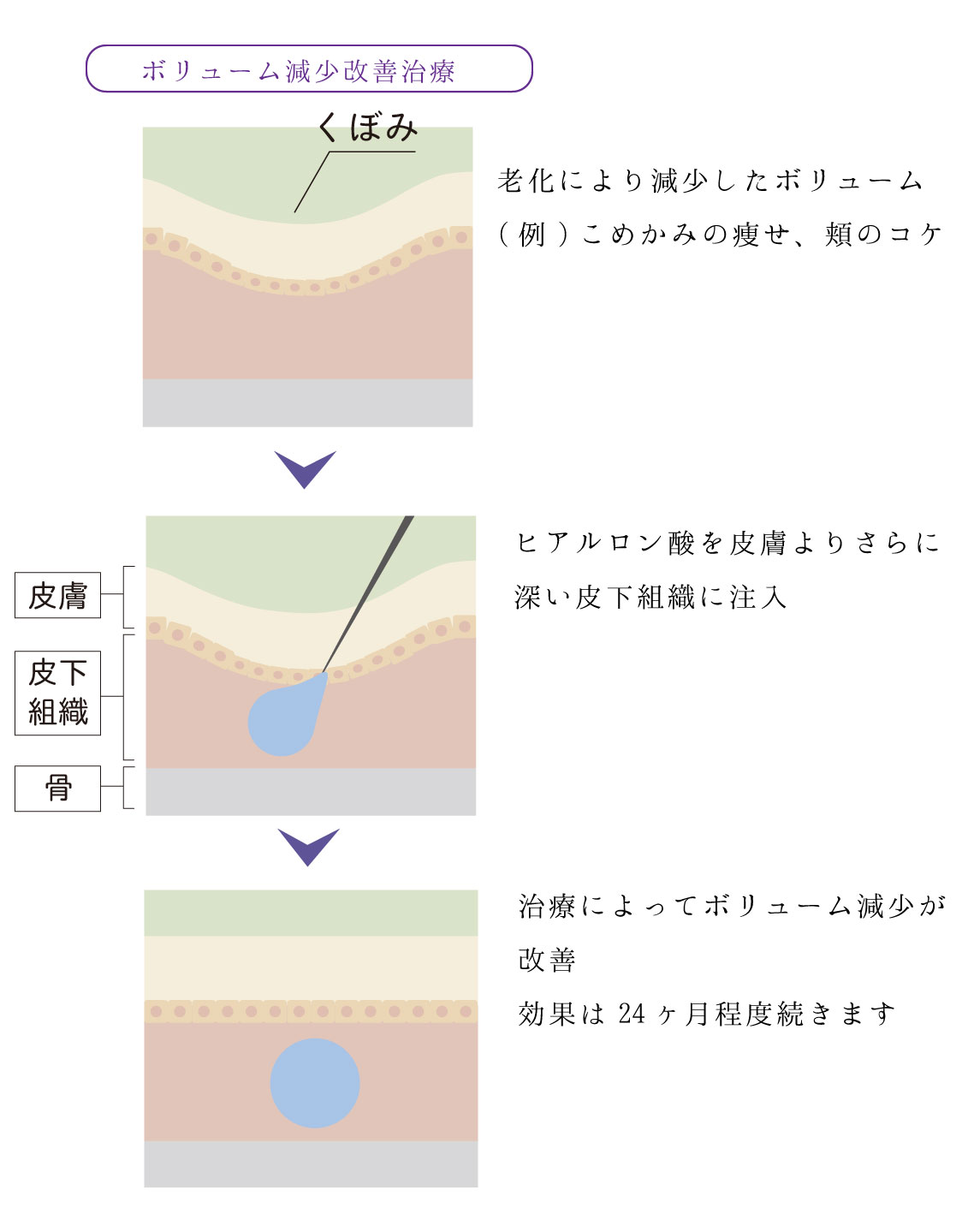 治療方法2