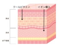 クールビタミンとイオン導入の浸透層の違いを説明する図