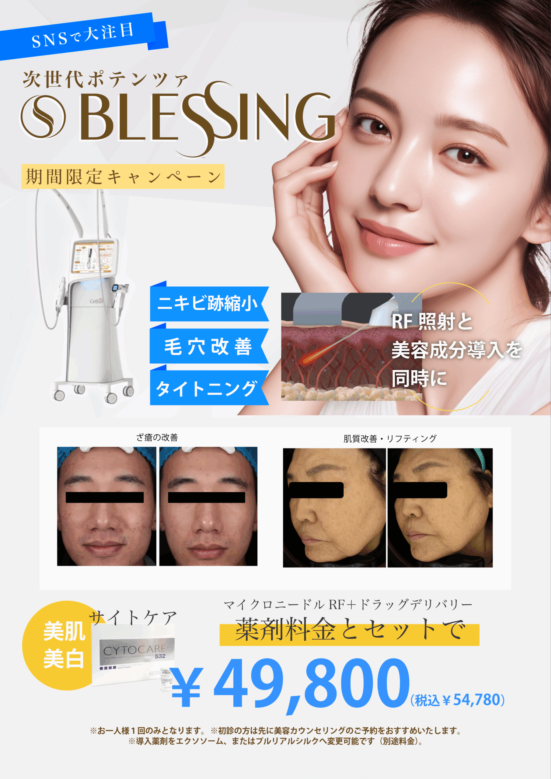 ブレッシングキャンペーンのご案内¥49,800（税込¥54,780）