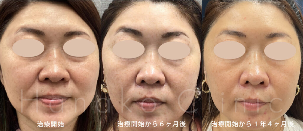 患者さまの経過