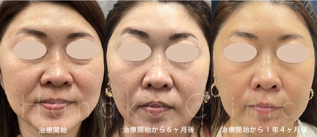 患者さまの経過