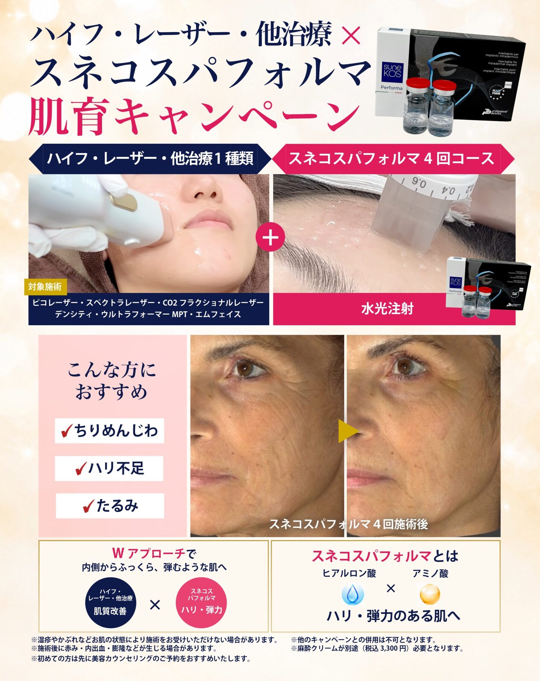 スネコスパフォルマ肌育キャンペーン 対象治療とスネコスパフォルマを組み合わせると治療代10%OFF